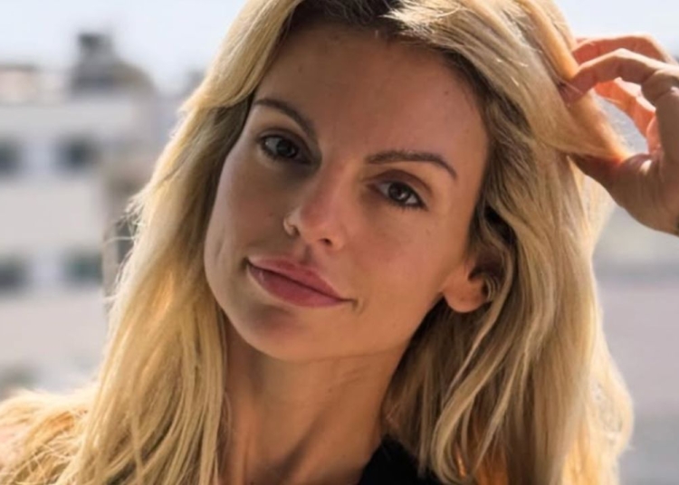 Fanny Rodrigues_Foto Instgarm